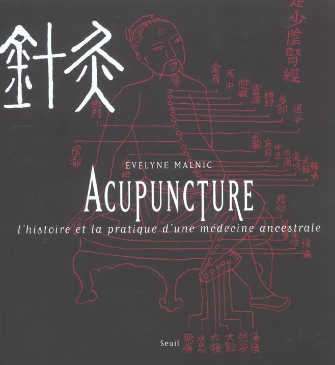 Acupuncture. l'histoire et la pratique d'une medecine ancestrale