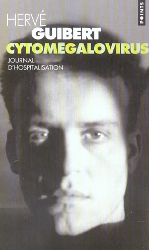 Cytomegalovirus. journal d'hospitalisation - flash vidéo