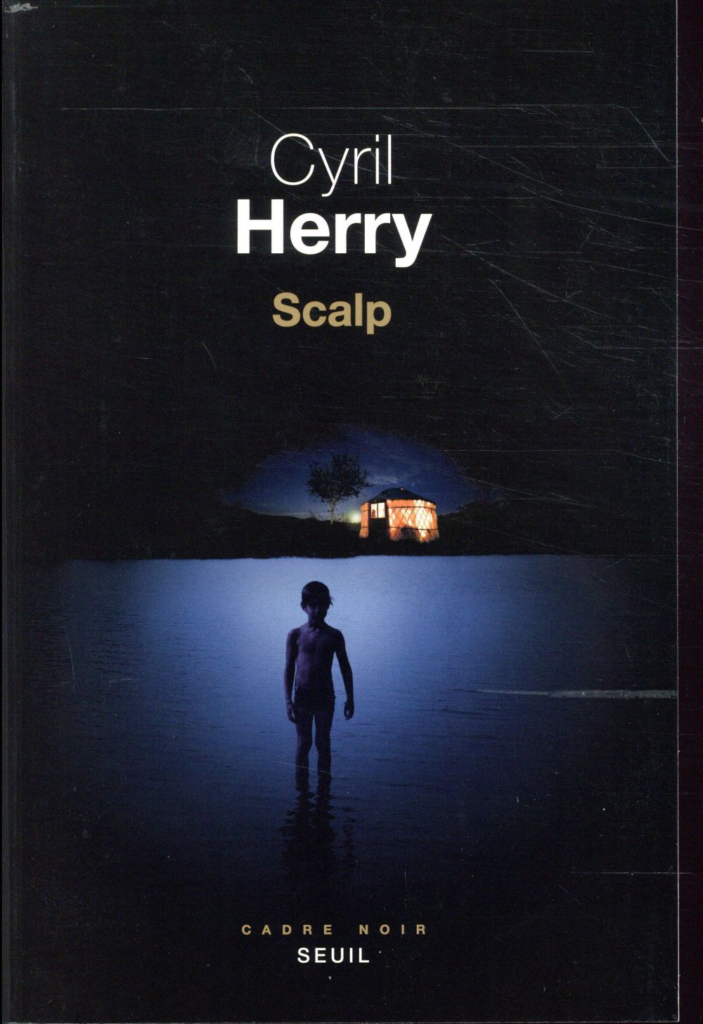 Scalp