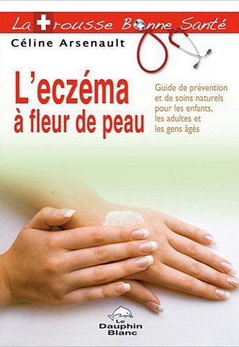 L'eczema à fleur de peau ; Guide de prévention et de soins naturels pour les enfants, les adultes et les gens âgés