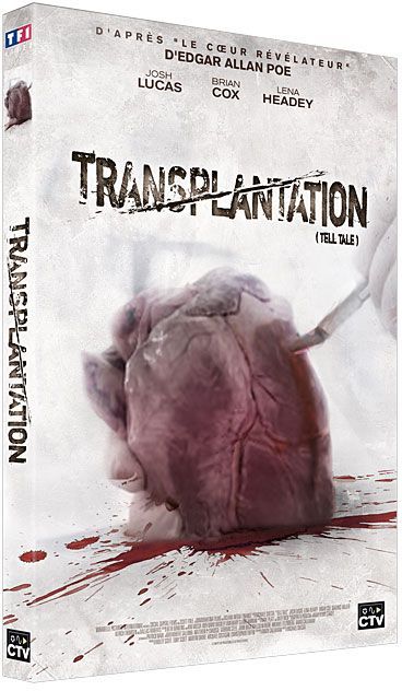 Tell Tale - Transplantation [DVD]