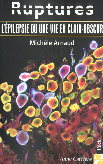 Ruptures epilepsie ou une vie