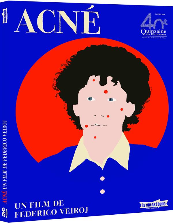 Acné [DVD] - flash vidéo