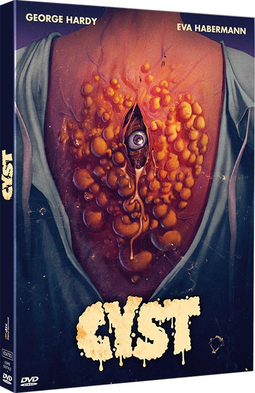 Cyst [DVD] - flash vidéo