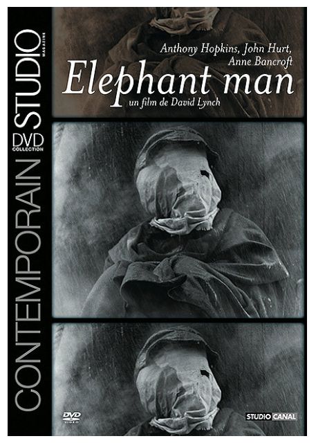 Elephant Man [DVD] - flash vidéo